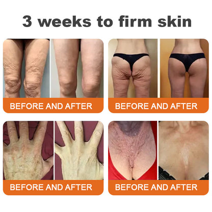 𝐋𝐞𝐧𝐚𝐫𝐨™ 𝐁𝐨𝐭𝐨𝐱 𝐁𝐞𝐞 𝐕𝐞𝐧𝐨𝐦 𝐅𝐢𝐫𝐦𝐢𝐧𝐠 𝐒𝐞𝐫𝐮𝐦 𝐒𝐭𝐢𝐜𝐤-𝐋𝐀𝐒𝐓 𝐃𝐀𝐘 𝟖𝟎% 𝐎𝐅𝐅👑